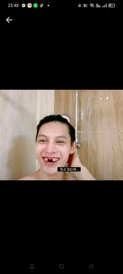 Chồng James thiếu răng 